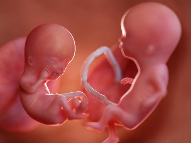 Foto Perkembangan Bayi Kembar Di Dalam Rahim Ibu Hamil Kumparan Com
