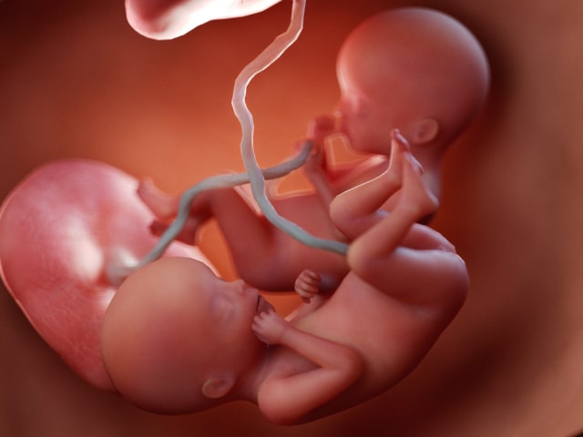 Bayi kembar usia 20 minggu kehamilan. Foto: Shutterstock