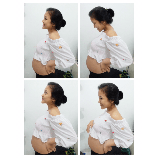 Tips Mengatasi Rasa Mual dan Muntah pada Trimester Pertama