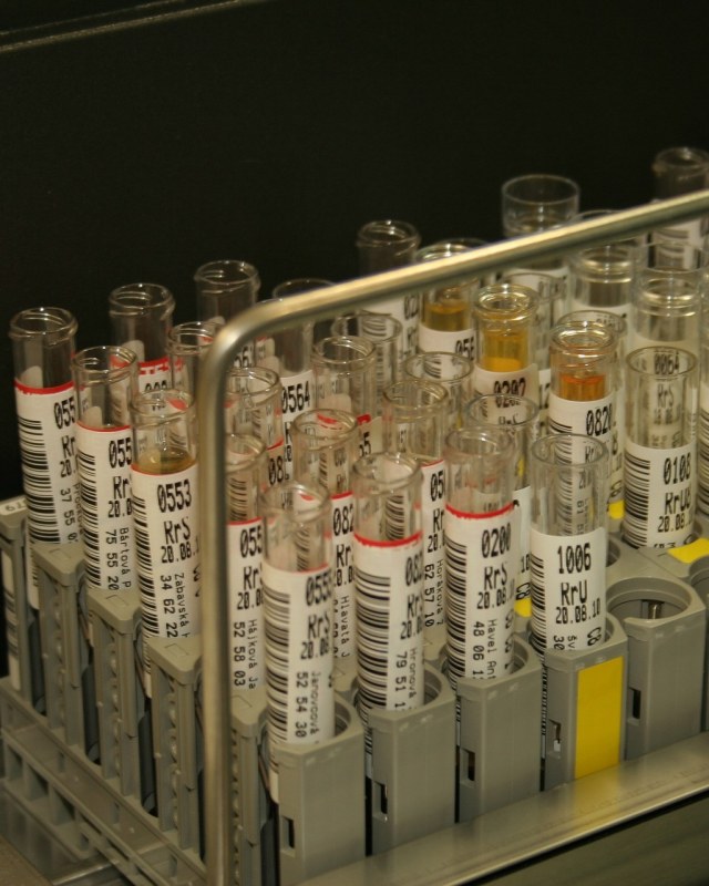 Ilustrasi tabung urine di laboratorium. Foto: Edusoft via Pixabay
