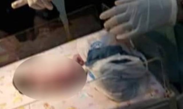 Bayi perempuan yang dibuang orang tuanya di Sidoarjo meninggal