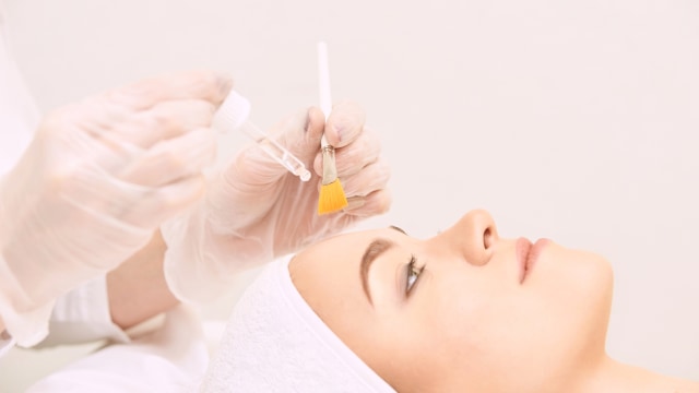 Ilustrasi Chemical peeling