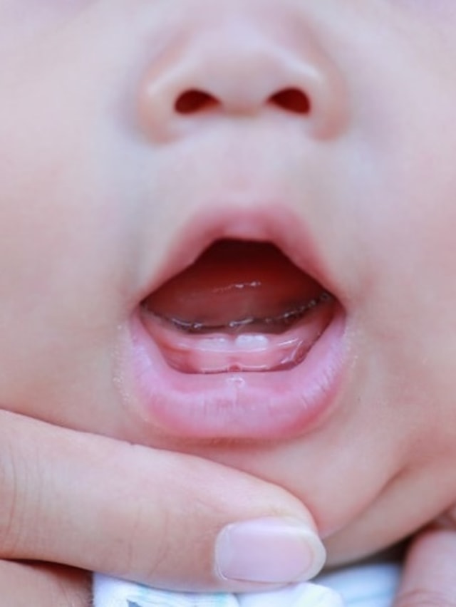 Ilustrasi gigi bayi.  Foto: Shutterstock