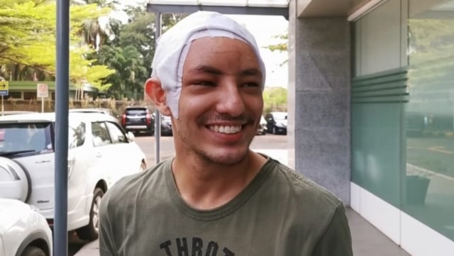Potret Dylan Carr Sudah Bisa Tersenyum Meski Kepala Masih Diperban (124832)