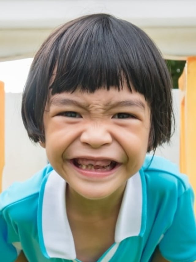 Ilustrasi karies gigi pada anak balita. Foto:  Shutterstock