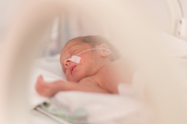 Bayi baru lahir pakai selang makanan. Foto: Shutterstock