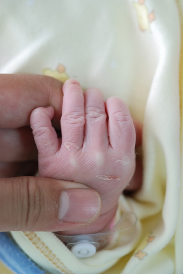 Ilustrasi bayi baru lahir alami TTN atau transient tachypnea of the newborn. Foto: Shutterstock