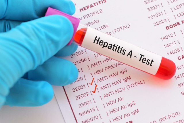 Ilustrasi Hepatitis A. Foto: Shutter Stock