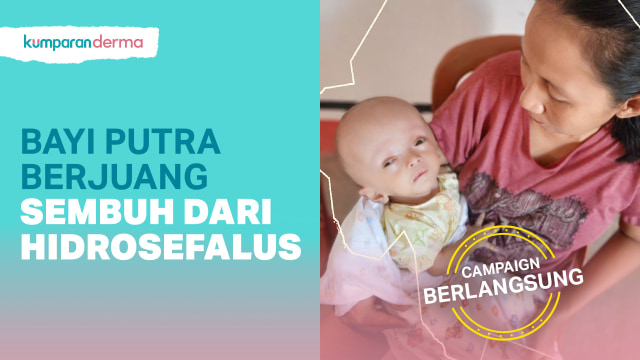 Bantu Putra, Bayi Hidrosefalus, Agar Segera Sembuh (130425)