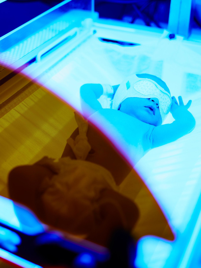 Ilustrasi bayi kuning. Foto: Shutter Stock