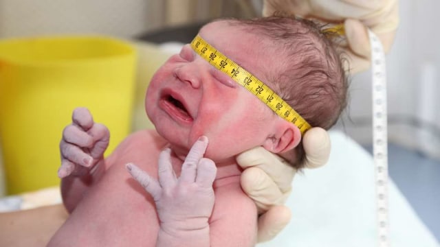 Trauma lahir pada bayi
