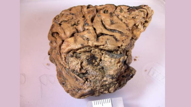 Heslington Brain, otak manusia kuno ini ditemukan di Inggris. Foto: Journal of the Royal Society Interface