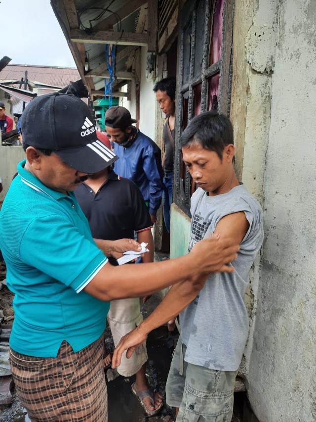 Sumadi diolesi obat oleh rekannya akibat luka bakar karena berusaha menyelamatkan sepeda motor. Foto: Yusrizal/Hi!Pontianak