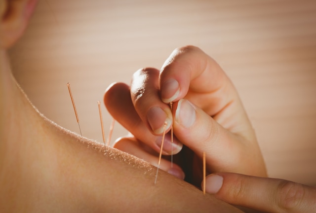 Kenapa Ibu Hamil Perlu Akupunktur? (56088)