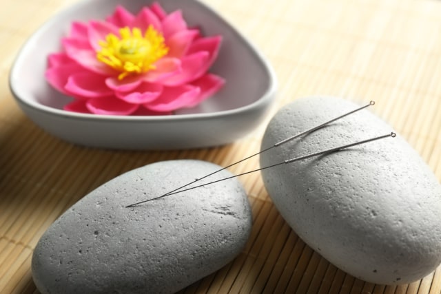 Benarkah Akupunktur Bisa Kurangi Sakit saat Persalinan? Foto: Shutterstock
