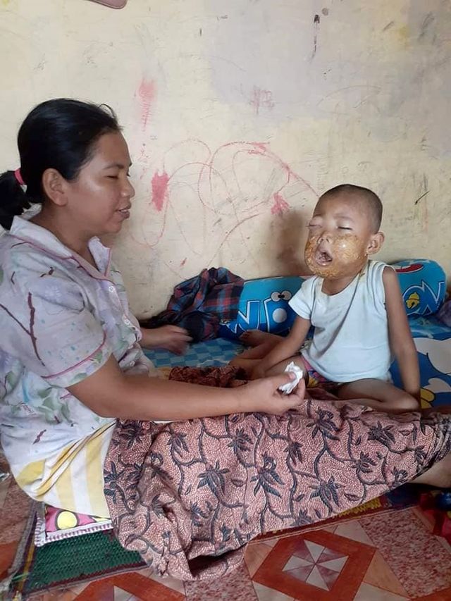 Muhammad Al Wahdi, bocah penderita tumor saat bersama ibunya. Foto: Facebook/Muhammad Fahruzi Manurung