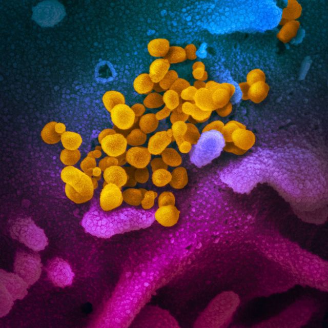 Wujud asli virus corona SARS-CoV-2 penyebab penyakit COVID-19. Foto: National Institute of Allergy and Infectious Diseases via flickr (CC BY 2.0)