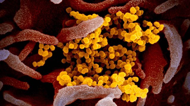 Wujud asli virus corona COVID-19 yang terlihat melalui mikroskop. Foto: National Institute of Allergy and Infectious Diseases via flickr (CC BY 2.0)