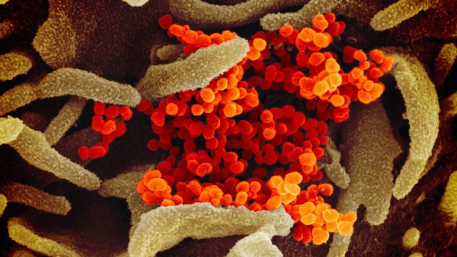 Wujud asli virus corona SARS-CoV-2 yang terlihat melalui mikroskop. Foto: National Institute of Allergy and Infectious Diseases via flickr (CC BY 2.0)