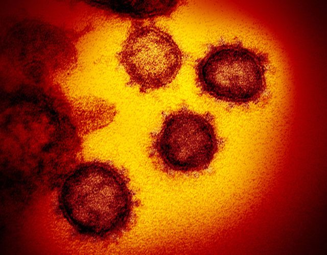 Wujud virus corona baru SARS-CoV-2 yang menyebabkan penyakit COVID-19, saat dilihat melalui mikroskop. Foto: National Institute of Allergy and Infectious Diseases via flickr (CC BY 2.0)