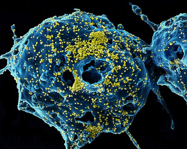 Gambar virus MERS
