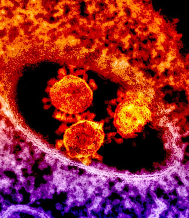 Gambar virus MERS