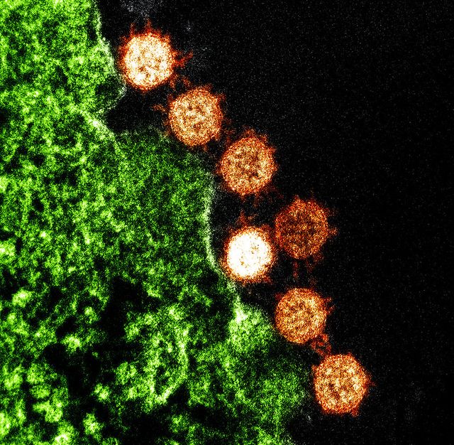 Gambar virus SARS