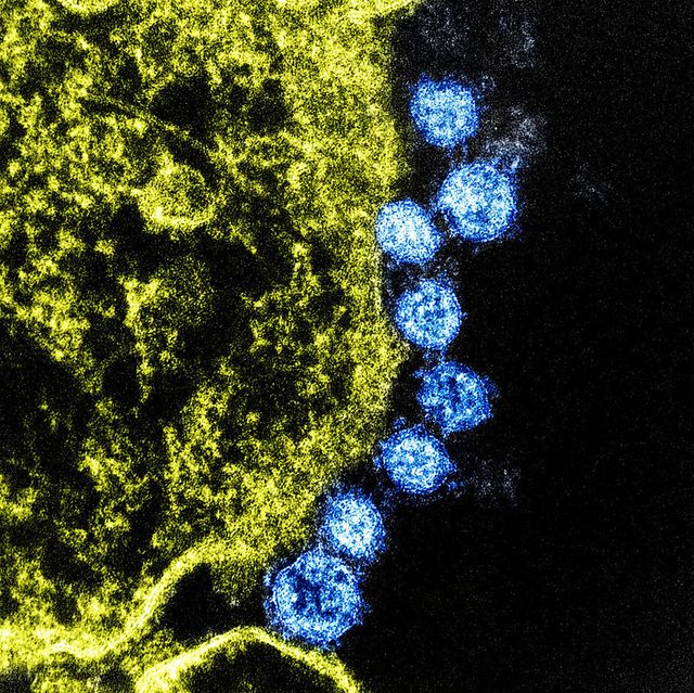 Gambar virus MERS
