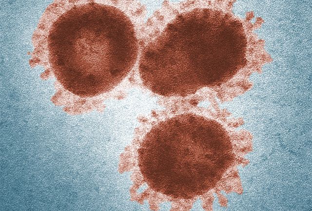 Gambar virus SARS