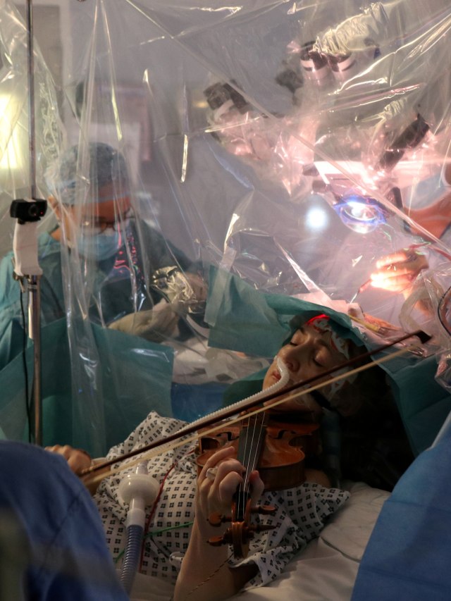 Dagmar Turner bermain biola saat ahli bedah mengangkat tumor otaknya di King's College Hospital, London, Inggris. Foto: King's College Hospital via REUTERS