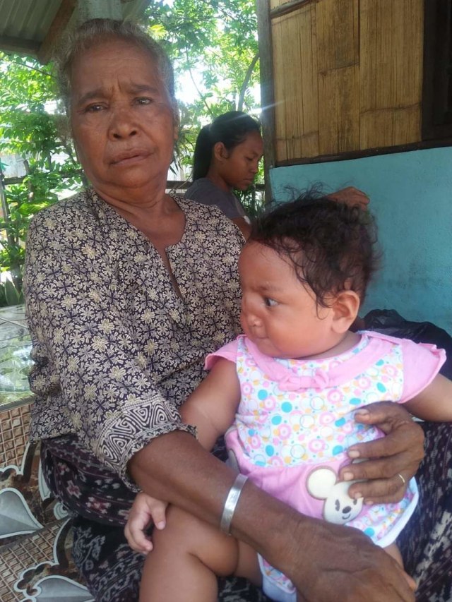 Apriliani, bayi 11 bulan yang menderita cacat bawaan. Foto: Arkadius Togo. 