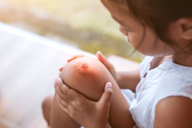 com-Ilustrasi seorang anak yang terluka di lutut. Foto: Shutterstock
