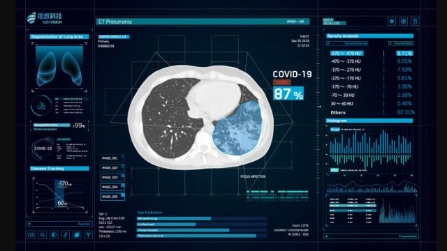 InterVision_CT-Pneumonia_COVID-19_AI_China.jpg