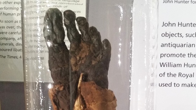 Foto: Kaki Mumi yang Disimpan Di Sebuah Museum. 