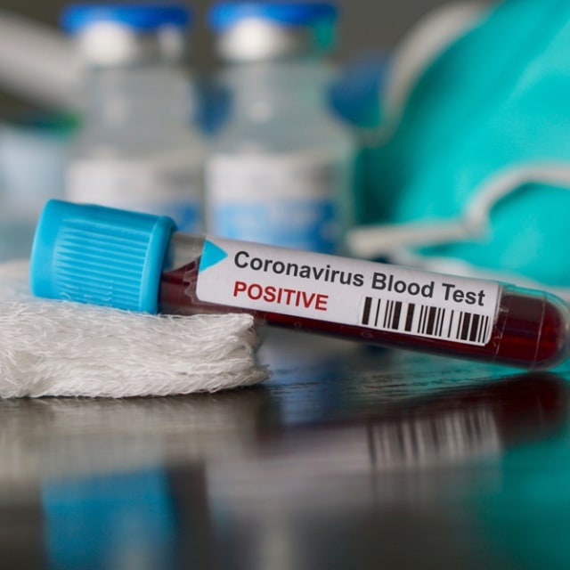 Ilustrasi tes darah pasien positif corona. Foto: Shutterstock