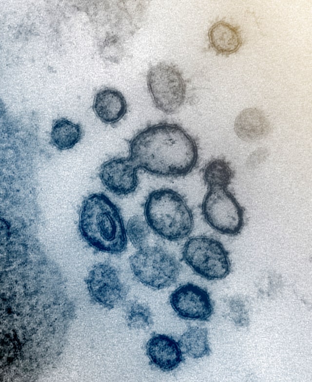 Sebuah mikrograf elektron transmisi yang tidak bertanggal dari partikel virus SARS-CoV-2 yang diambil dari pasien yang diisolasi di Amerika Serikat. Foto: NIAID Integrated Research Facility (IRF) via REUTERS