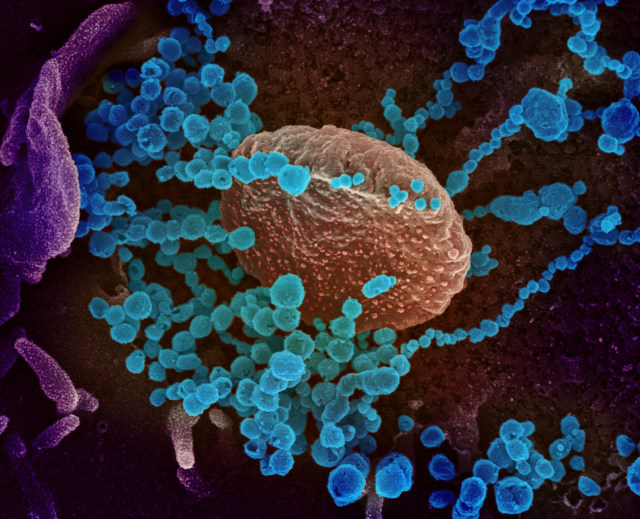 Gambar mikroskop elektron pemindaian ini menunjukkan SARS-CoV-2 (biru bundar) Foto: NIAID Integrated Research Facility (IRF) via REUTERS