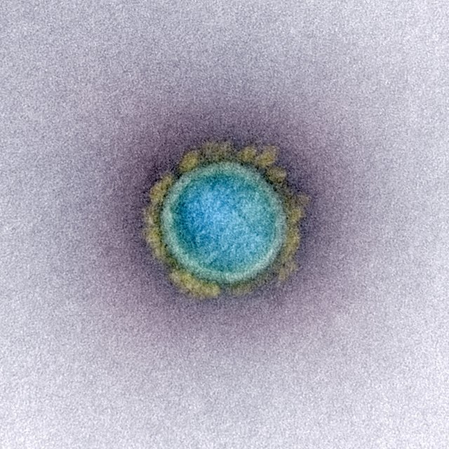 Sebuah mikrograf elektron transmisi yang tidak bertanggal dari partikel virus SARS-CoV-2. Foto: NIAID Integrated Research Facility (IRF) via REUTERS