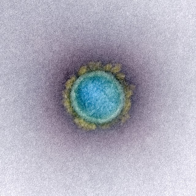 Wujud virus SARS-CoV-2 Virus corona