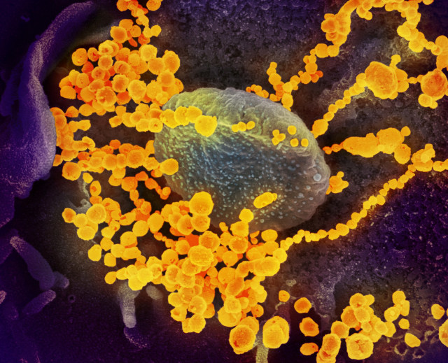 Wujud virus SARS-CoV-2 Virus corona