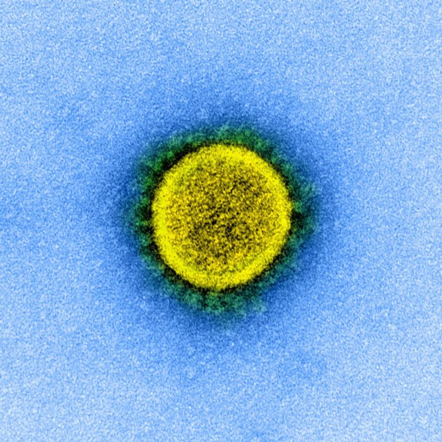 Sebuah mikrograf elektron transmisi yang tidak bertanggal dari partikel virus SARS-CoV-2. Foto: NIAID Integrated Research Facility (IRF) via REUTERS