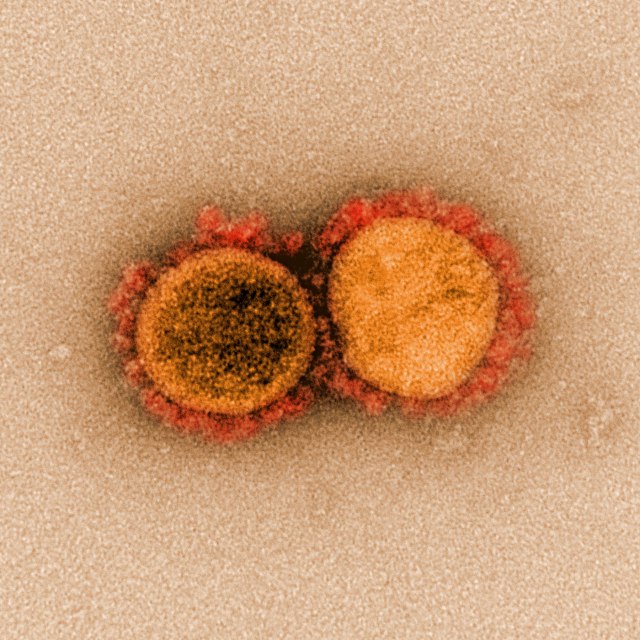 Partikel virus SARS-CoV-2. Foto: NIAID Integrated Research Facility (IRF) via REUTERS
