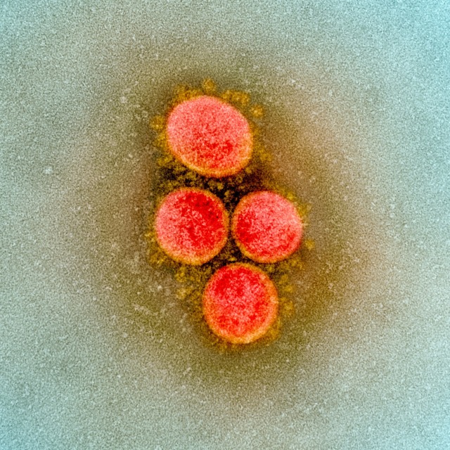 Partikel virus SARS-CoV-2. Foto: NIAID Integrated Research Facility (IRF) via REUTERS