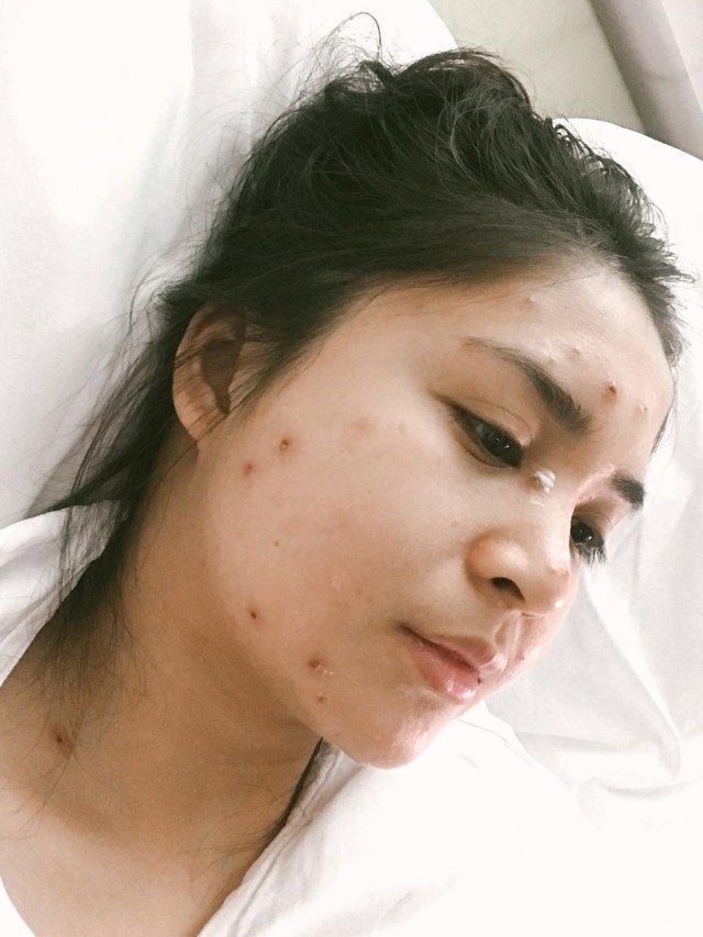 Putri Titian alami cacar air saat hamil anak kedua.
Foto: Instagram/@putrititian