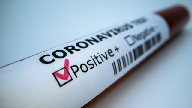 Ilustrasi hasil pemeriksaan pasien corona. Foto: Shutterstock
