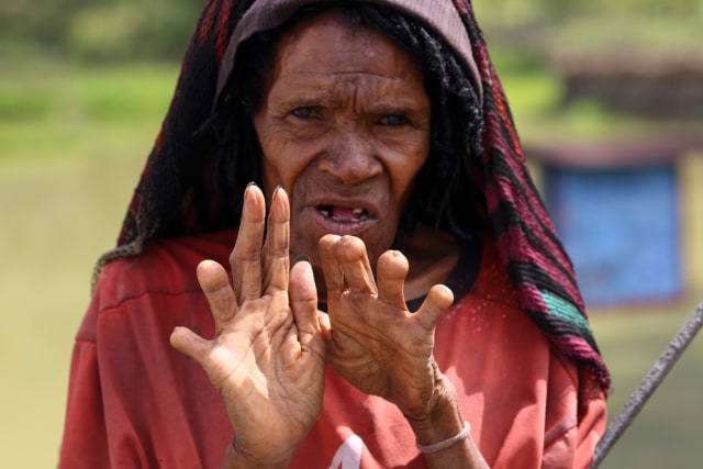 Masyarakat papua nugini yang memotong jarinya untuk menjalani tradisi Iki Palek Foto: Shutter Stock 