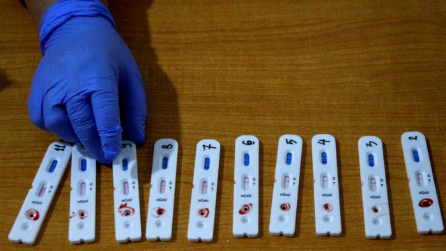 Petugas medis memperlihatkan sampel darah jurnalis saat Rapid Test atau pemeriksaan cepat COVID-19 di Rumah Jabatan Gubernur Sulsel, Makassar (15/4). Foto: ANTARA FOTO/Abriawan Abhe
