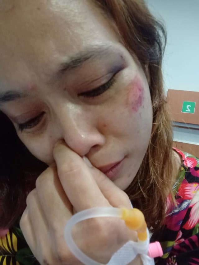 PTR, Dina mengalami luka usia dirampok dan ditipu di Medan