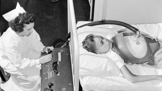 Seorang anak di Amerika menjalani pemeriksaan setelah mengidap penyakit Polio pada tahun 1955. Foto: Getty Images/Three Lions