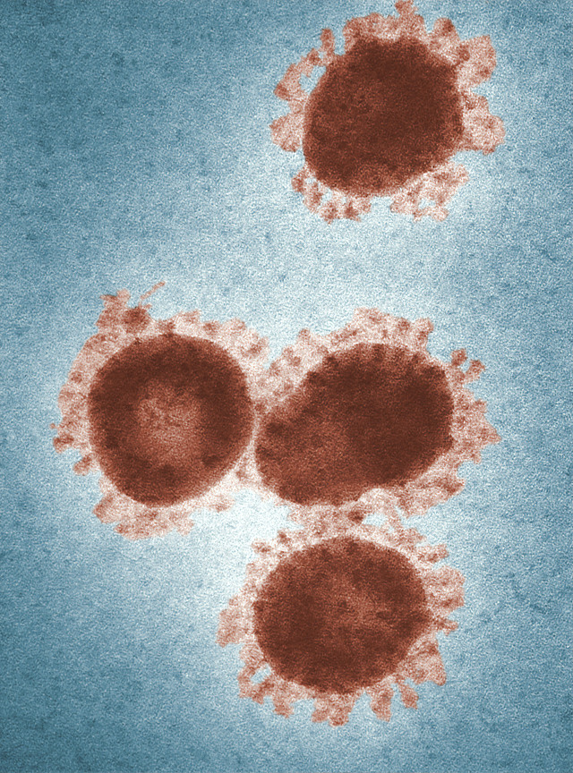 Ilustrasi Virus Corona. Unplash